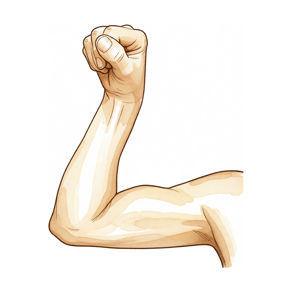 The 'Popeye' bulge in the upper arm after a rupture of the long head of biceps.