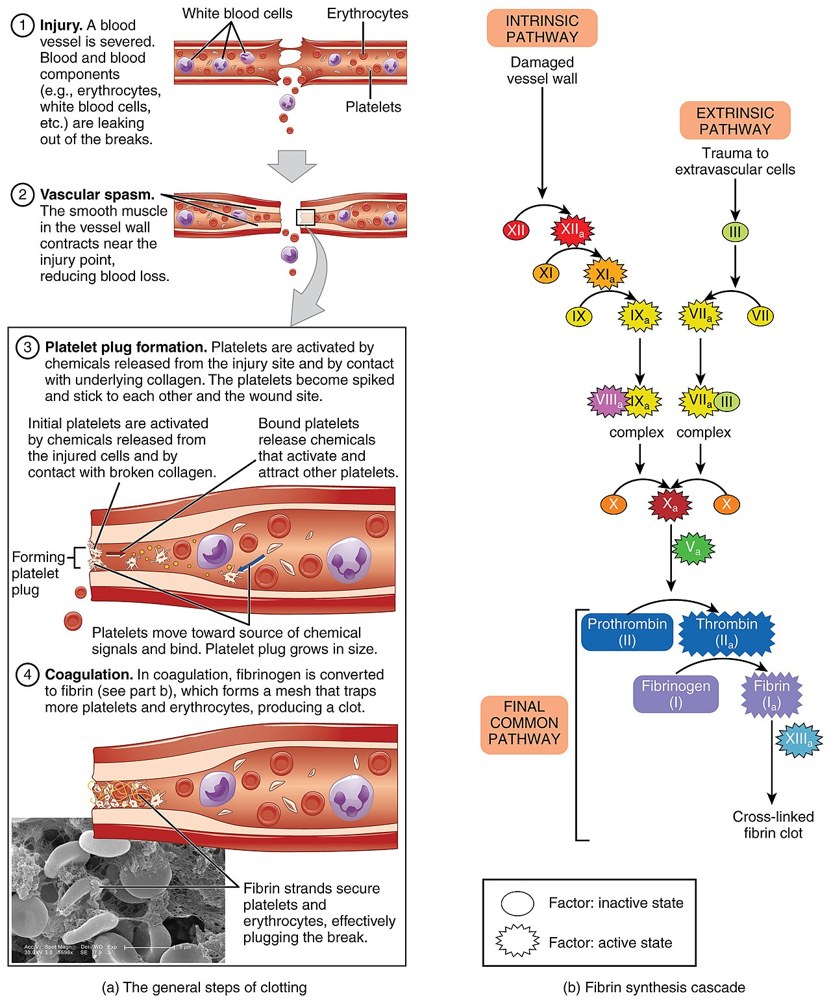 Illustration of a blood clot: platelets and red cells caught in a fibrin mesh.