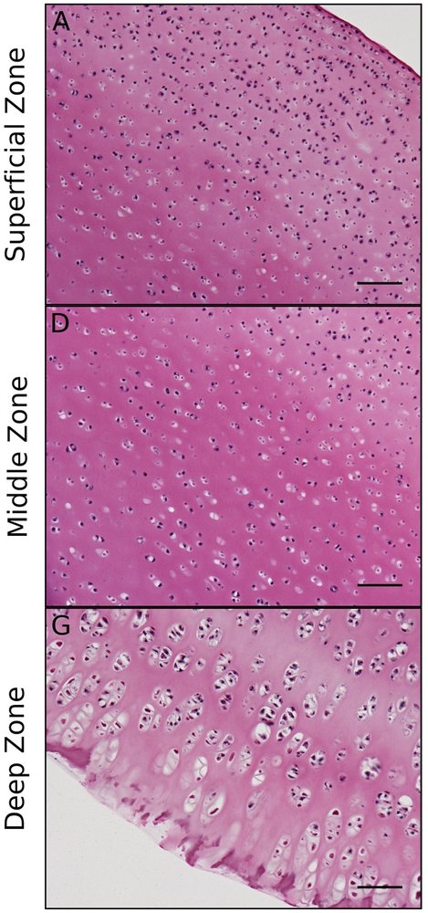 Histology of articular cartilage in three zones — superficial (flattened cells), middle, and deep (columnar cells) — showing how chondrocyte shape changes with depth.