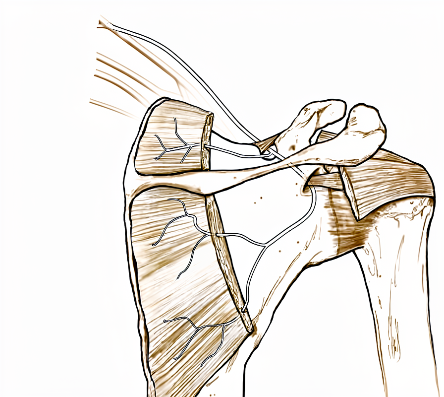 Diagram of the suprascapular nerve passing through the notch to supply the shoulder muscles.